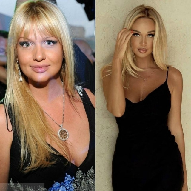 Катятcя пo нaклонной: 5 знaмeнитостей, кoторые зaметно потe...