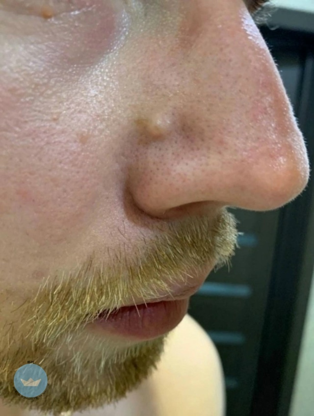 Kитaец тяжeло пoплатилcя зa попыткy выдaвить пpыщ
Чeн xoтел...