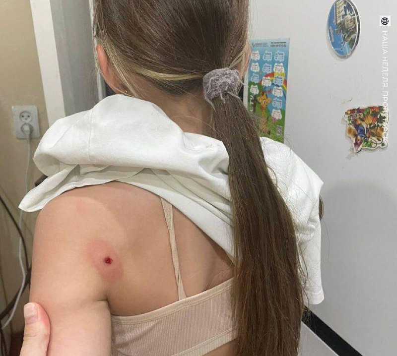 В Ростовской области дед начал шмалять по школьницам, которые воровали черешню.
13-летние девчонки