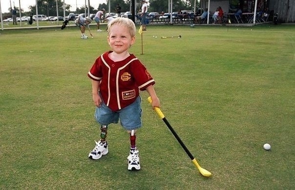 У Коди МакКасланда редкое заболевание - разновидность ...