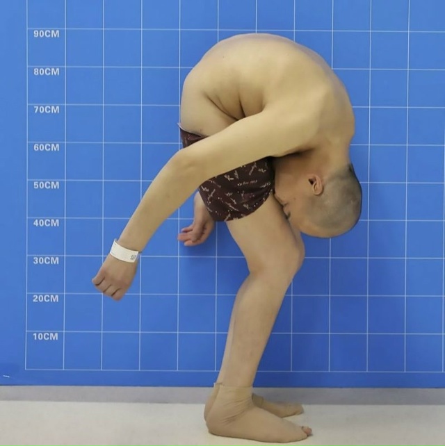 46-летний Ли Хуа в таком согнутом состоянии прожил окол?...