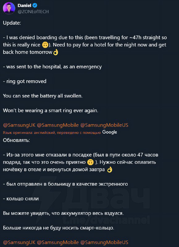 Умное кольцо превратилось в орудие для пыток
Парень был в аэропорту, когда батарея его умного кольц