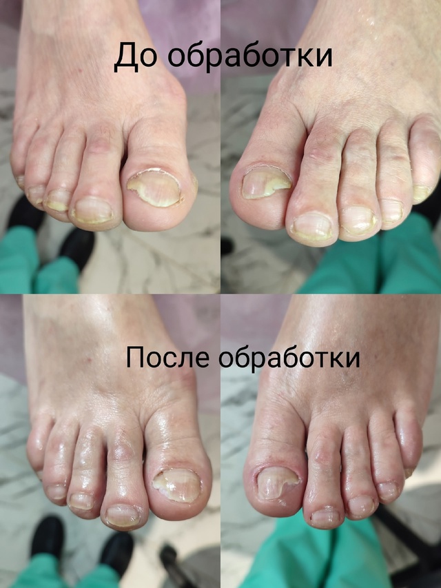 Добрый день, меня зовут Елена, я подолог с медицинским ...