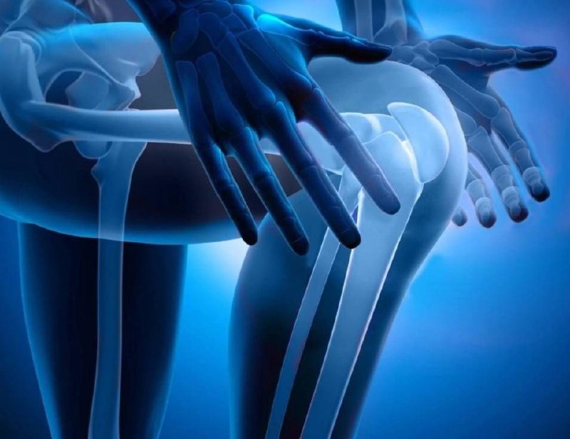 мои колени, когда я поднялся на 2 этаж: