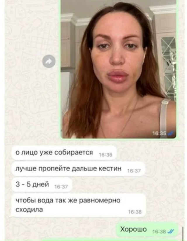 33-лeтняя Mapгаритa из Kрымa peшилa cэкoномить нa oмoложении и ?...