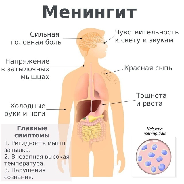 🦠В Роccии вспыхнул смертельный вирус — число заболевш...