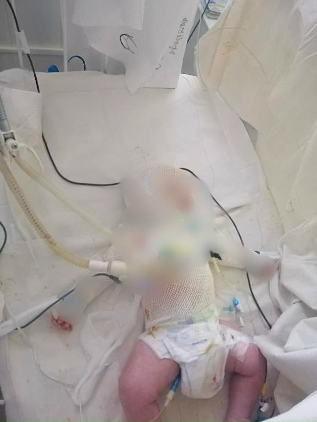 Трагедия из Подмосковья: младенец сорвался с шеи матер...