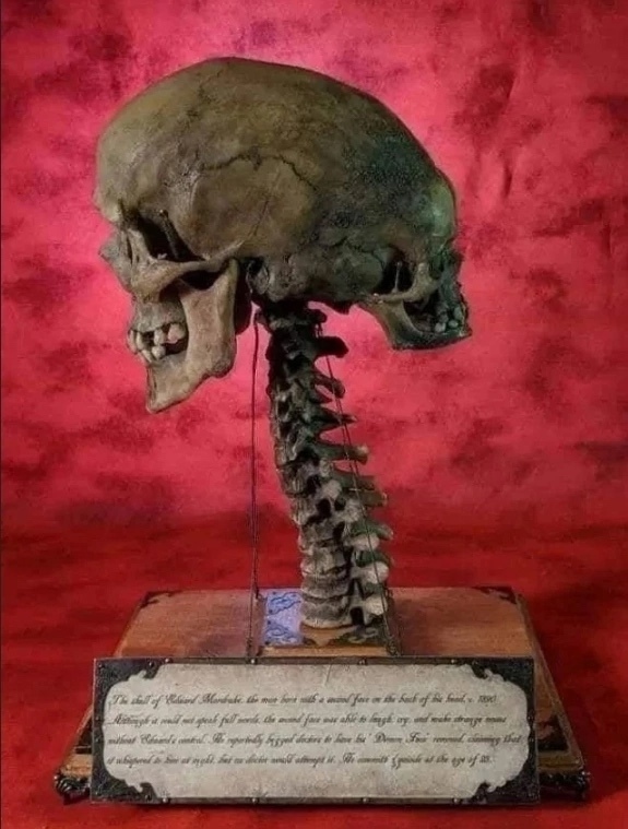 История Эдварда Мордрейка, появившегося на свет в поза...