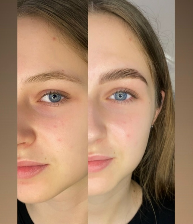 Добрый день,меня зовут Алина,я мастер-бровист!
-В спект?...