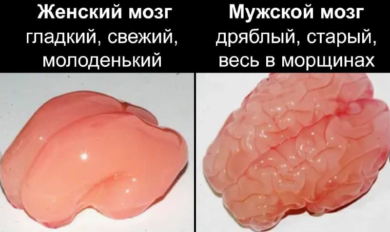 Мозг мужчин стареет гораздо быстрее, чем у женщин — исследование. После диагностики 500 человек норв