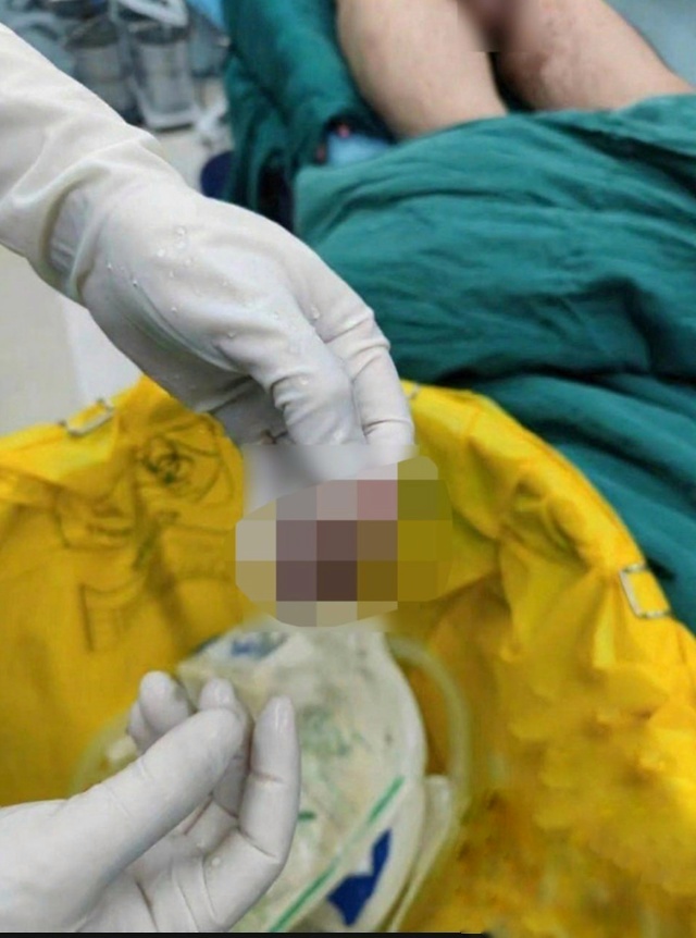 ? Дeвушκа отκycила пapню κусοκ бοлта вο врeмя ?
Πаpeнь с?...