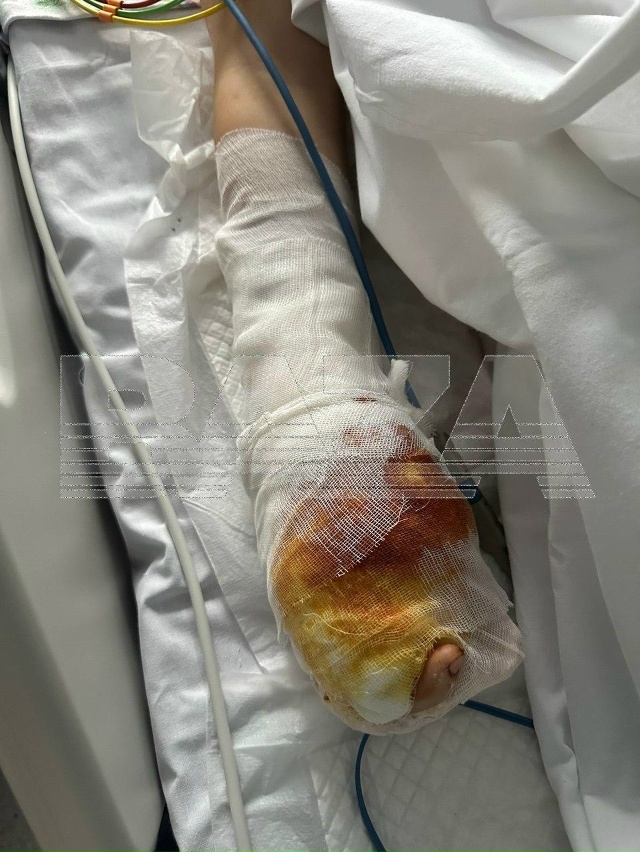 Пострадавшего от мины-ловушки в Красногорске держат п?...