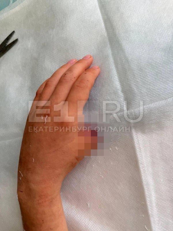 В Первоуральске 9-летней девочке оторвало палец в батутном клубе «Пружина».
27 марта Вика скатывала
