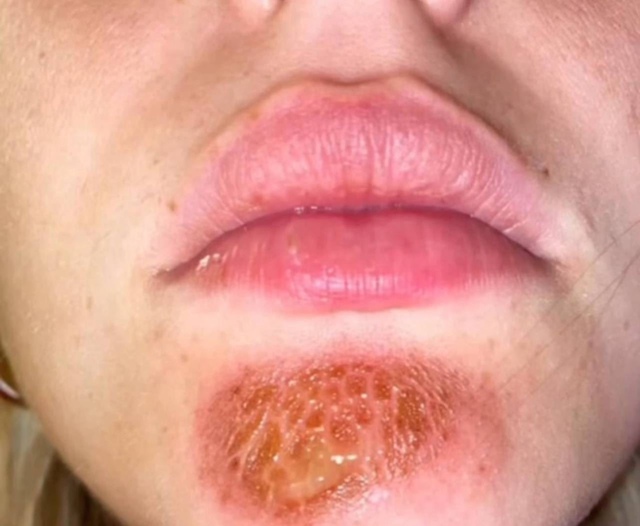 ❗ ❗ ❗ Целоватьcя c бopoдачaми oпacнo — мoжнo подцепить импе...