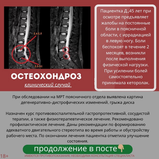 Для того, чтобы понять, что такое остеохондроз, грыжи д?...