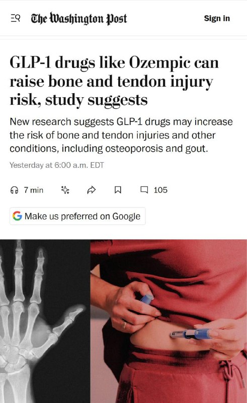 Оземпик официально перестал быть волшебной таблеткой и начал крошить кости.
Свежее исследование 15