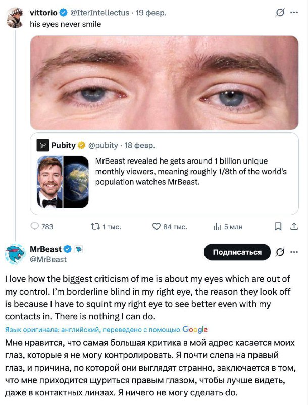 Мистер Бист почти ослеп на один глаз.
Фанаты заметили, что на фото у блогера «грустный взгляд». В о