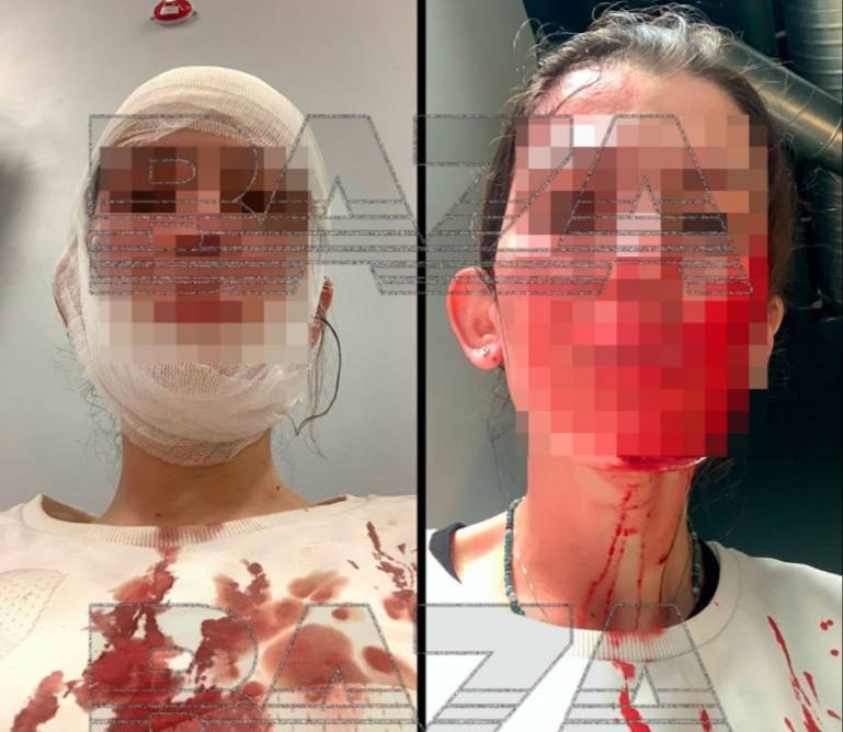 😳Сотрудница офиса в Москве вылила кипяток в лицо коллеге, а потом ещё и ударила кружкой по голове