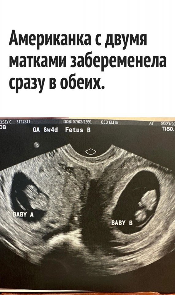 Это феноменально все😅