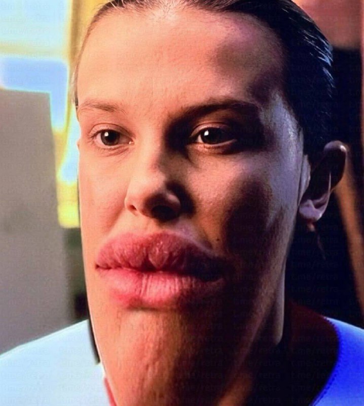 😨В Сети обсуждают внешность Милли Бобби Браун, которую заподозрили в использовании ботокса перед съё