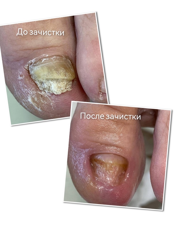 Специалист-подолог приглашает жителей Акбулака и близ...