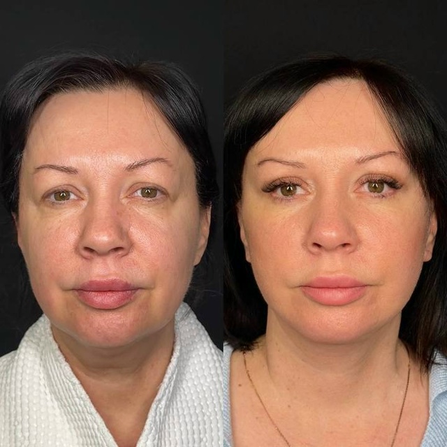 Дарья Поцелуева перешла от рекламы девушки списываеще...