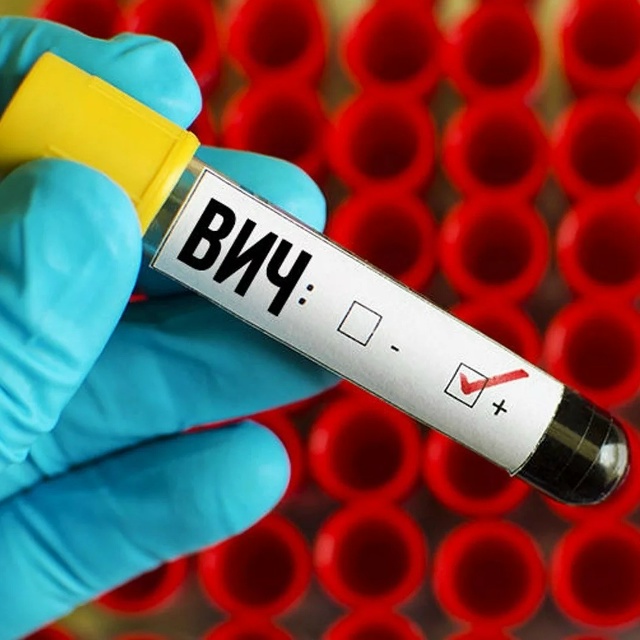 В России около каждого сотого жителя живёт с ВИЧ-инфек?...