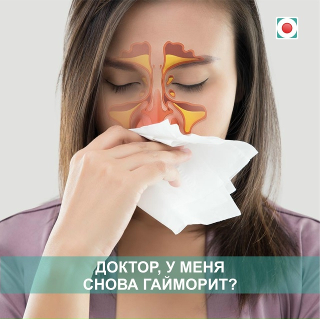 «ДОКТОР, У МЕНЯ СНОВА ГАЙМОРИТ?» ПОЧЕМУ НАСМОРК НЕ СТОИ...