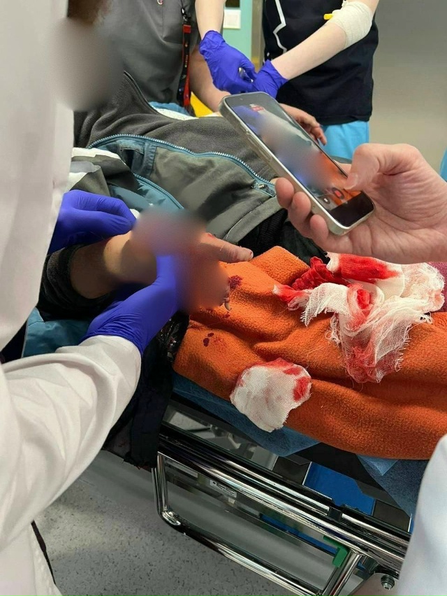 😱Ребёнок потерял пальцы из-за найденной на улице взры...