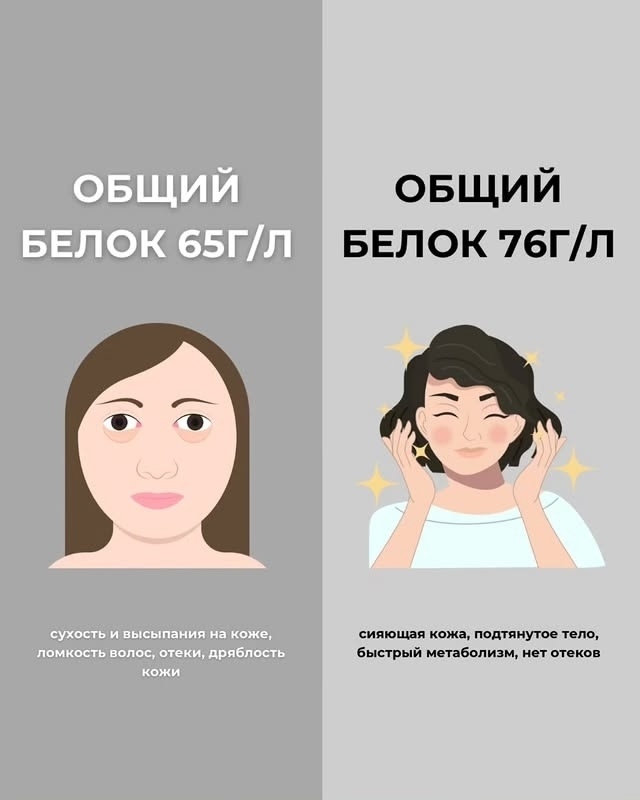 ПРИЗНАКИ НЕХВАТКИ ВИТАМИНОВ: КАК ПОНЯТЬ, КАКИХ ВИТАМИН...