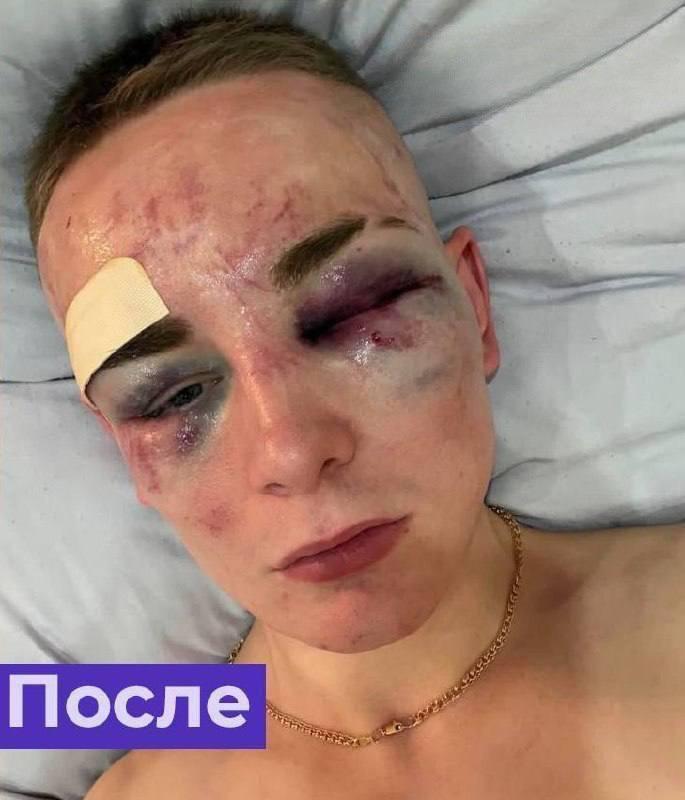 Жителя Пензы жестоко избили во время конфликта с арендаторшей, а уже в больнице у него неожиданно на