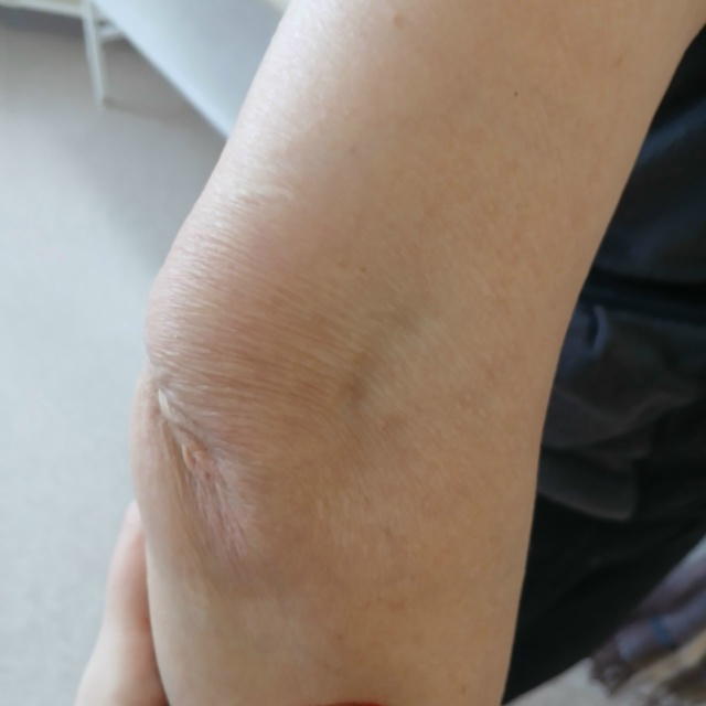 😰Вчера моя мама пострадала из-за темноты в посёлке Ст?...