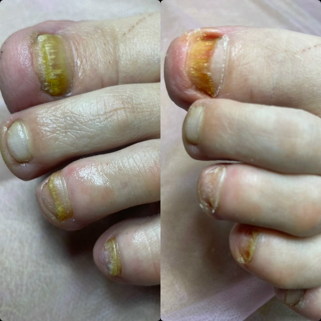 Добрый день!
С 14.11-16.11 ведет прием Нижегородский подоло?...