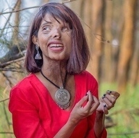 Анмол Родригес из Мумбаи, Индия, ослепла на один глаз и ...