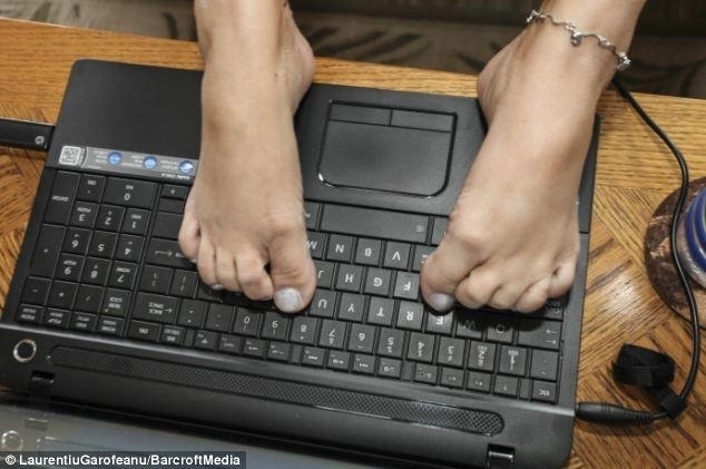 35 летняя Линда Бэннон и 9-летний Тимми родились с синдр?...