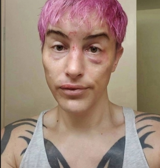 Алана Маклафлин, 38-летняя спортсменка из США, одержала ...