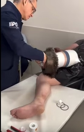 Установка бионического протеза ноги является очень по...