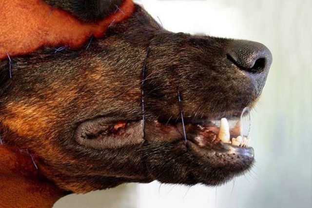 Родриго Брага из Бразилии подверг себя операции для то...