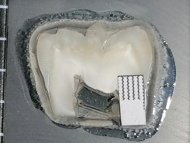 В России разработано тонкоплёночное зубное покрытие, ?...