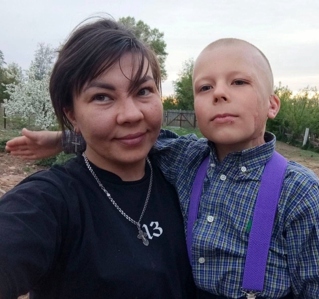 В Оренбурге врачи сумели восстановить лицо мальчика, к...