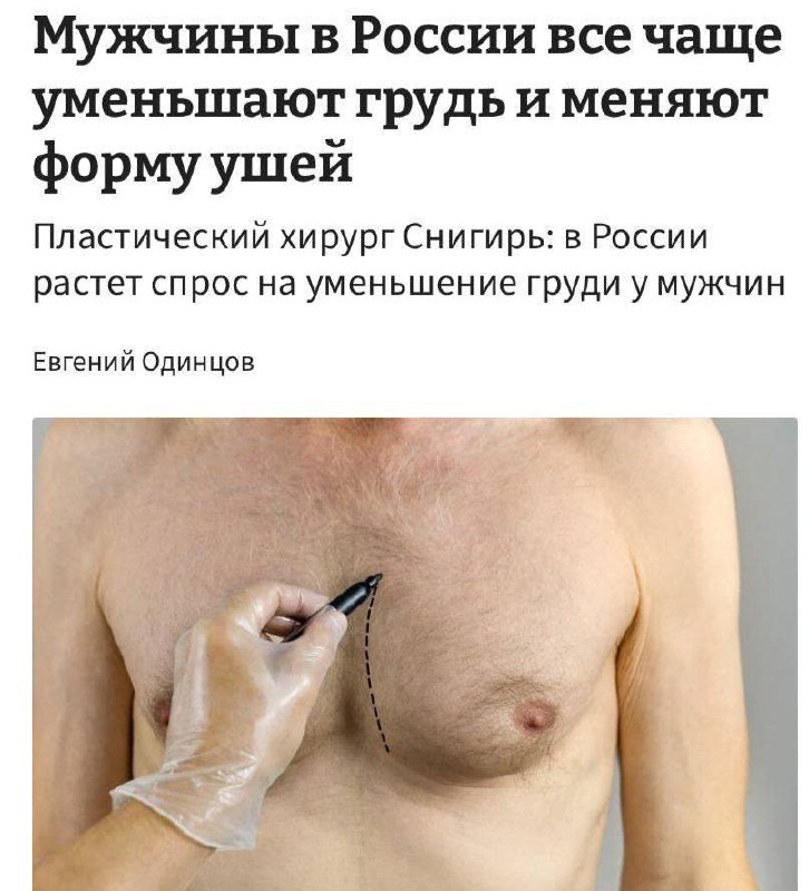 В России мужики массово уменьшают сиськи. Что? Да.
Врачи называют операцию по уменьшению груди одн