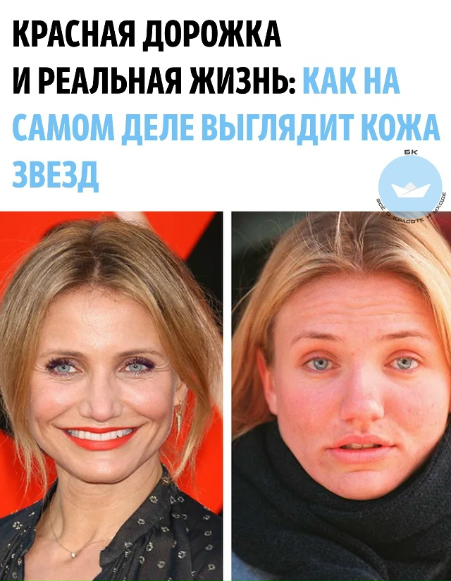 Кажeтся, у знaмeнитоcтeй всeгда бeзупречная кожa, нo нa cамо?...