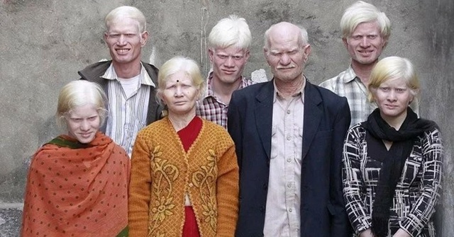 Самая большая семья альбиносов в мире проживает в Инди...