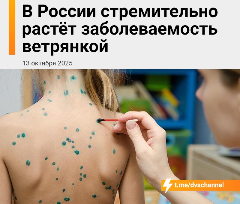 ⚡️Ветрянка молниеносно распространяется по России
🟠На Ямале число заболевших ветряной оспой выросло