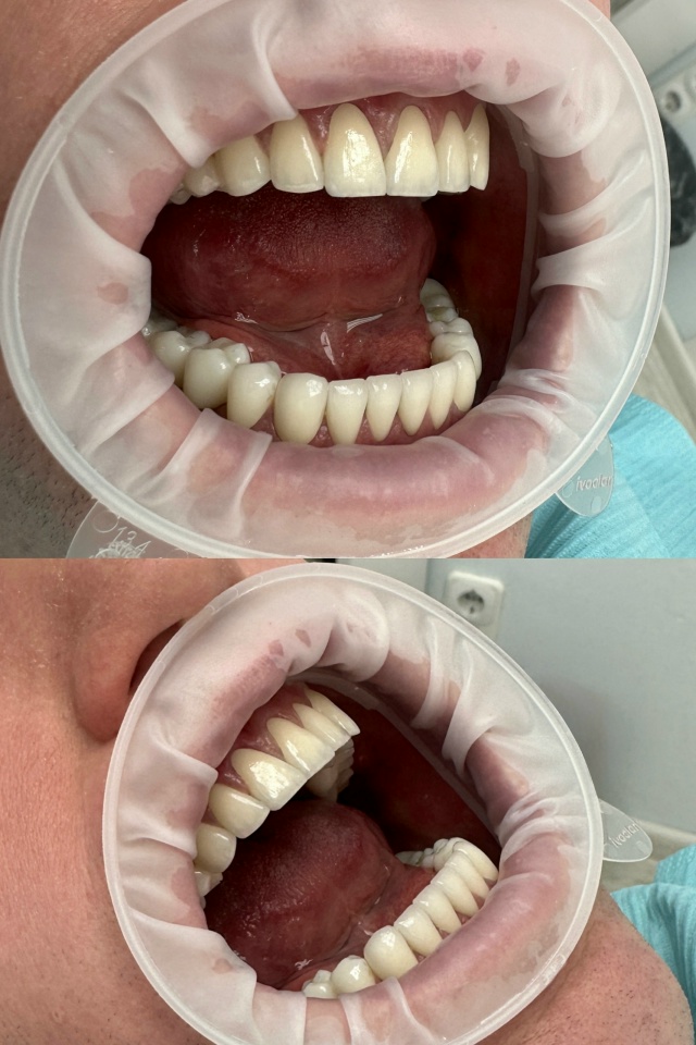 СТОМАТОЛОГИЯ Эмидент 📲 8-800-555-73-67 • nfk.emident.ru
🏠 Нефтека...