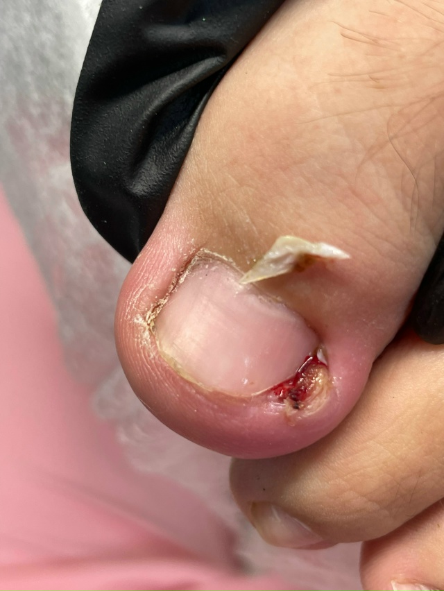 Добрый день!
С 14.11-16.11 ведет прием Нижегородский подоло?...