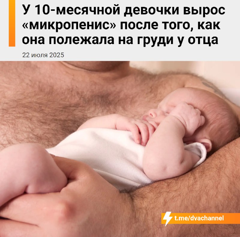 У 10-месячной девочки из Швеции вырос «микропенис» после того, как она часто лежала на груди у отца.