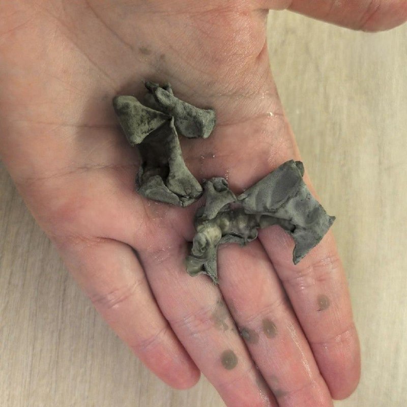 Ребёнку стало плохо после сока «ФрутоНяня».
В упаковке нашли серый налёт, похожий на плесень, посл