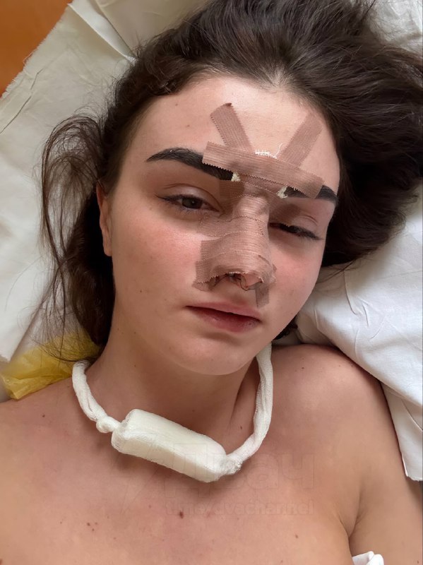 Омский боец ММА сломал жене нос из-за «плохо вымытой» раковины
Она вышла за него через два месяца п