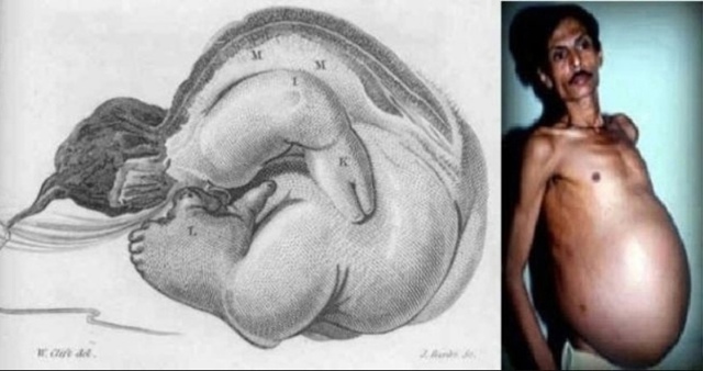 На протяжении тридцати шести лет Санджу Бхагат скрыва?...